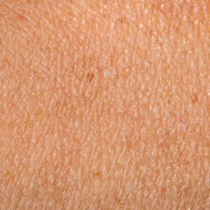 a,woman's,skin,close,up
